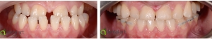 ortodontie_30_1